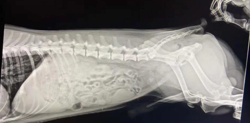 膀胱結石非手術