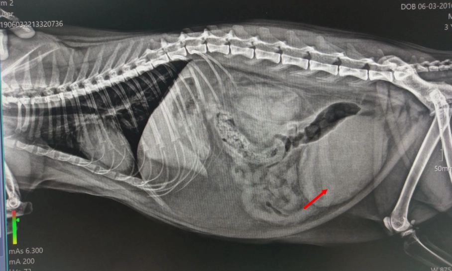 膀胱結石非手術