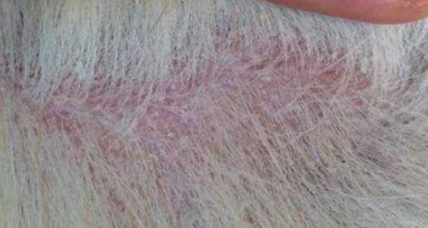 犬小芽孢菌感染