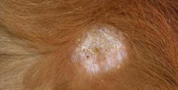 犬小芽孢菌感染